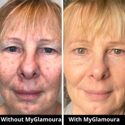 GLED Pro — Advanced LED Skincare Mask