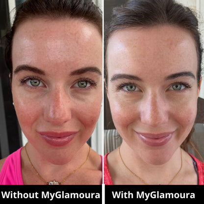 GLED Pro — Advanced LED Skincare Mask