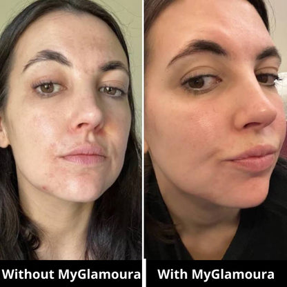 GLED Pro — Advanced LED Skincare Mask