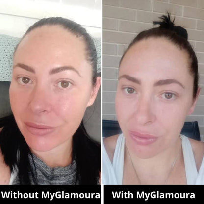 GLED Pro — Advanced LED Skincare Mask